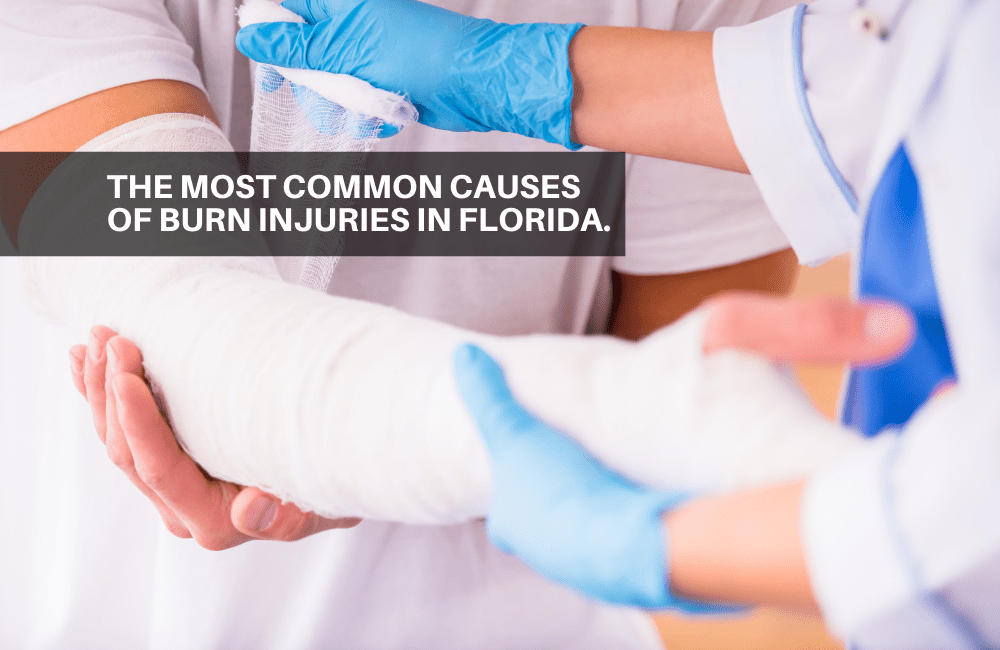 the-most-common-causes-of-burn-injuries-in-florida